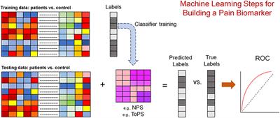 Brain Imaging Biomarkers for Chronic Pain